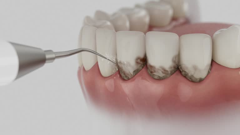 Trusted Emergency Dentist service in Kansas City, KS - Dentist Open Now